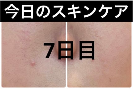 クリアアップローション 1/IPSA/化粧水を使ったクチコミ(1枚目)