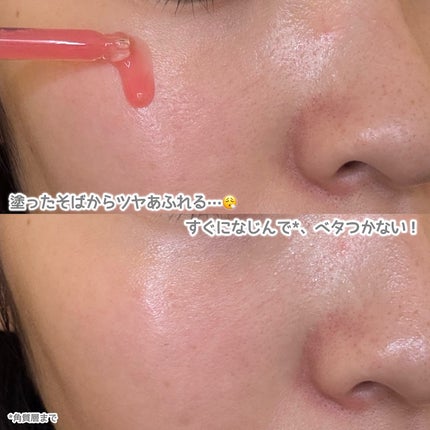 ミシャ ビタビープラス美容液/MISSHA/美容液を使ったクチコミ(3枚目)