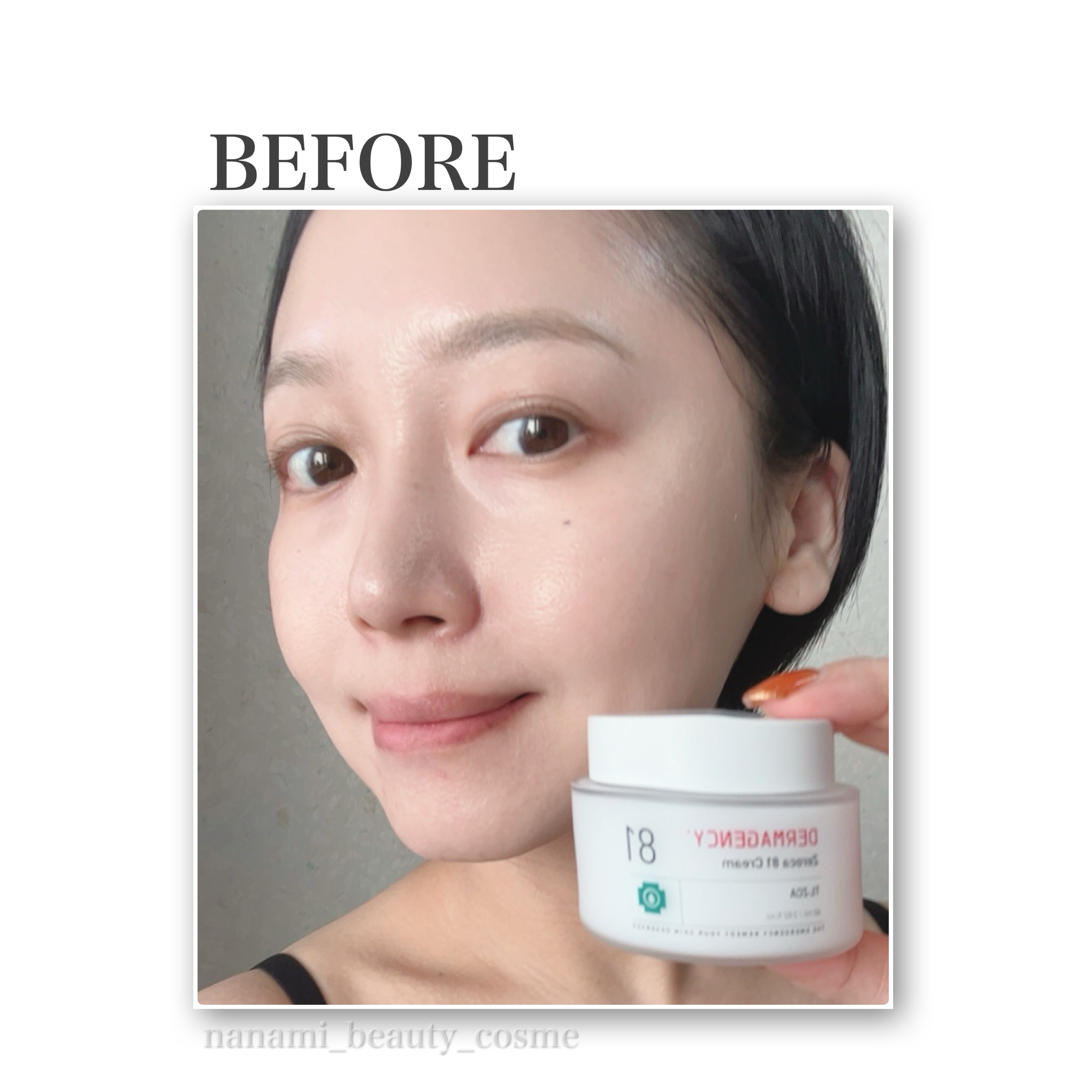 ダーマジェンシー ゼロカ81 クリーム/DERMAGENCY/フェイスクリームを使ったクチコミ（3枚目）