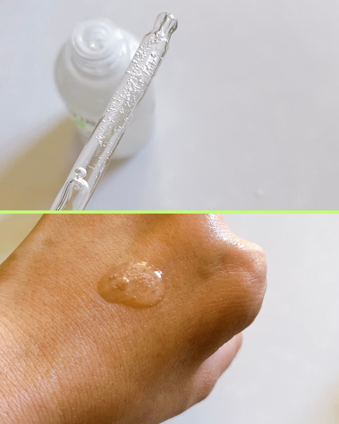 ノスカナイントラブルセラムS/FATION/美容液を使ったクチコミ（3枚目）