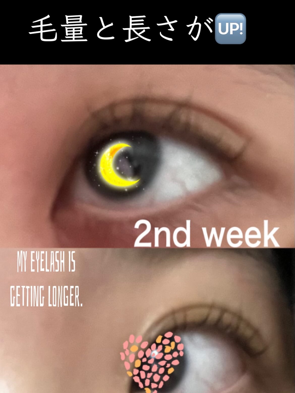 えりさフォロバ200%LIPSパートナー on LIPS 「@scalpd_eye(全写真マスカラなし)スカルプDまつ毛美..」(1枚目)