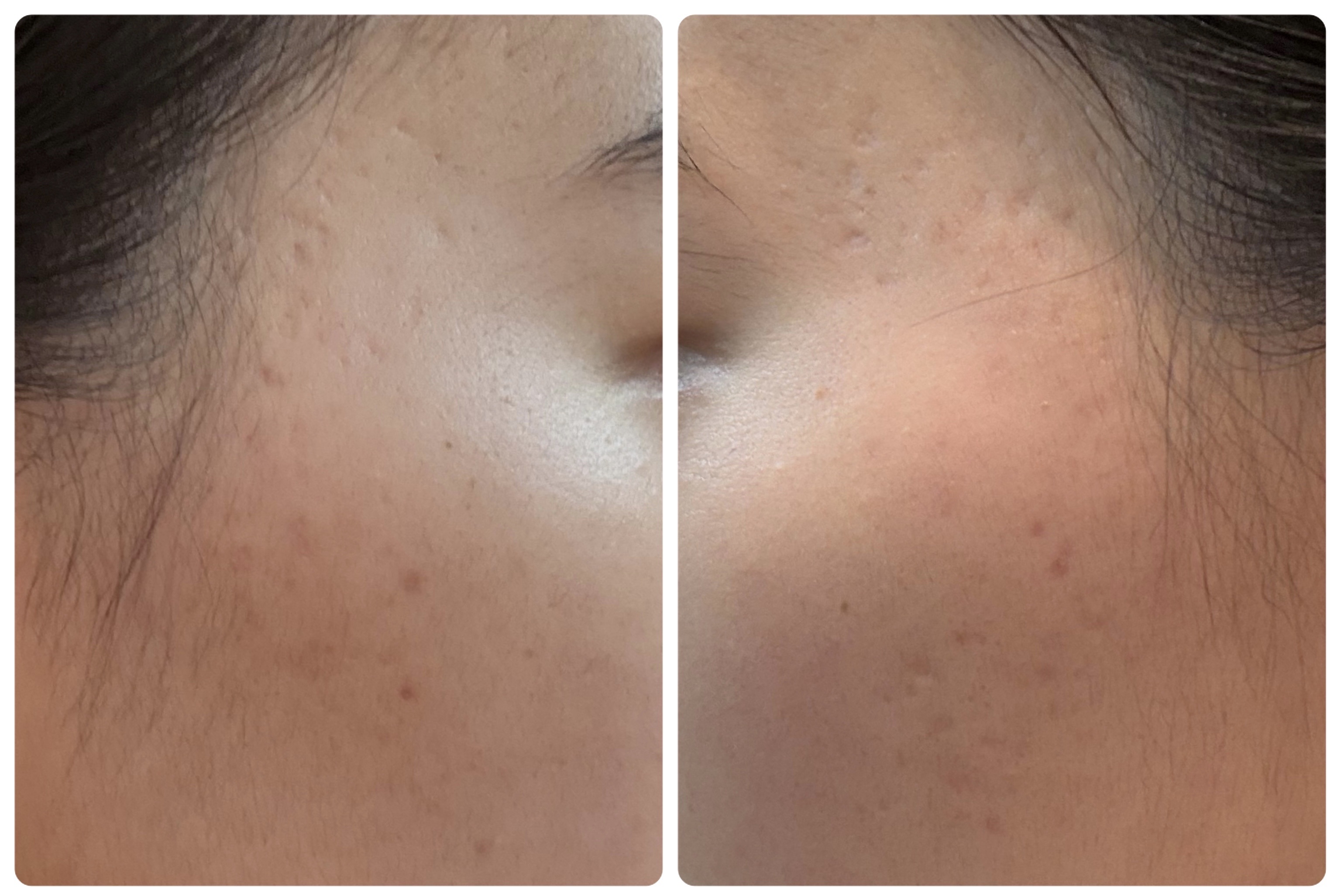 Hadaral 十味敗毒湯錠(医薬品)/大峰堂/その他を使ったクチコミ（2枚目）