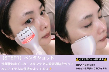 ポアタイトニングブーストセラム/CELORABY/美容液を使ったクチコミ(2枚目)