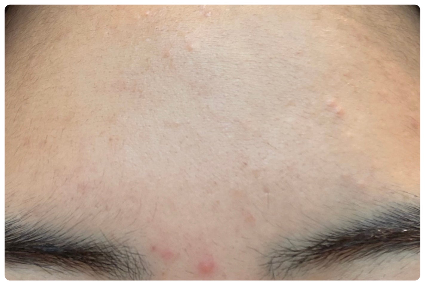 クリアアップローション 1/IPSA/化粧水を使ったクチコミ(4枚目)