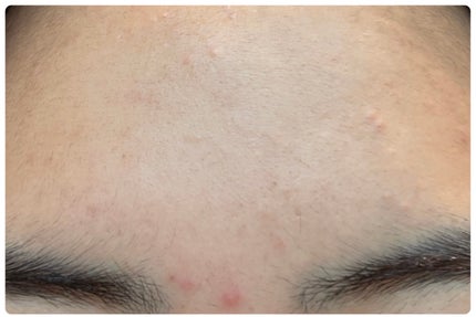 クリアアップローション 1/IPSA/化粧水を使ったクチコミ(4枚目)