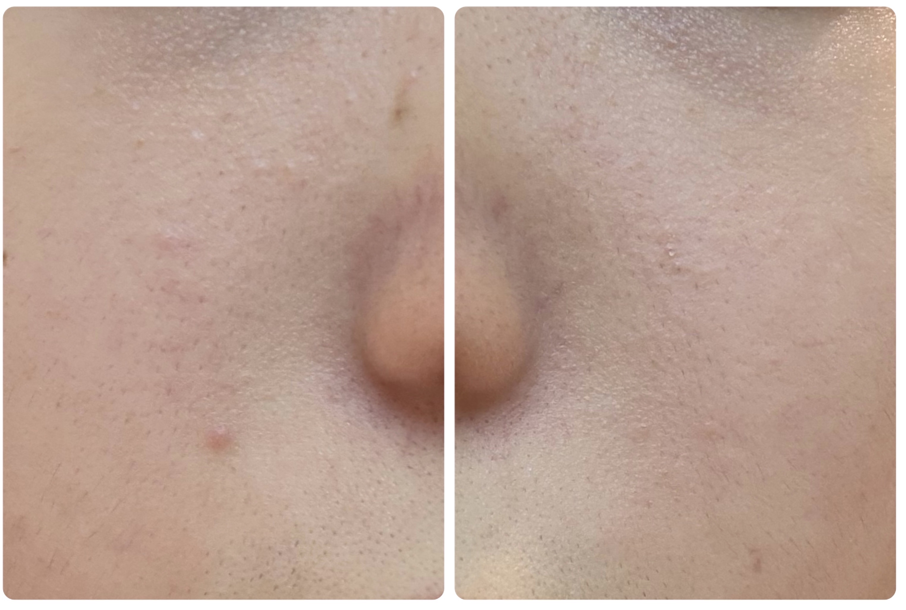 Hadaral 十味敗毒湯錠(医薬品)/大峰堂/その他を使ったクチコミ（3枚目）