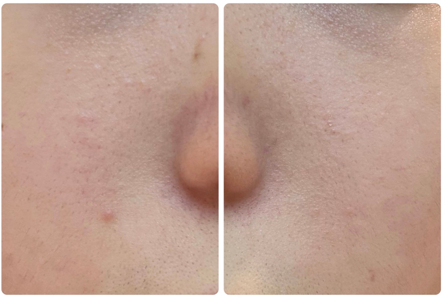 クリアアップローション 1/IPSA/化粧水を使ったクチコミ(3枚目)