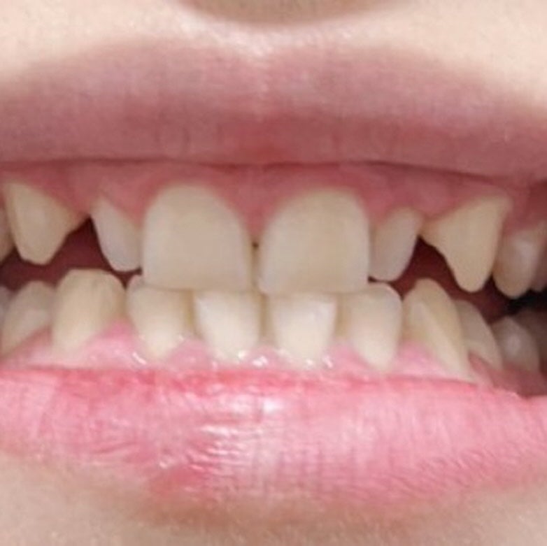 hanað¹ãã©ããããŸãð¹ on LIPS ã#PRéåœçŸå®¹æ¥çã§æµè¡äžïŒ0.1mmã®è¶
èåã§æ¬ç©ã®æ¯ã®ã..ãïŒ2æç®ïŒ