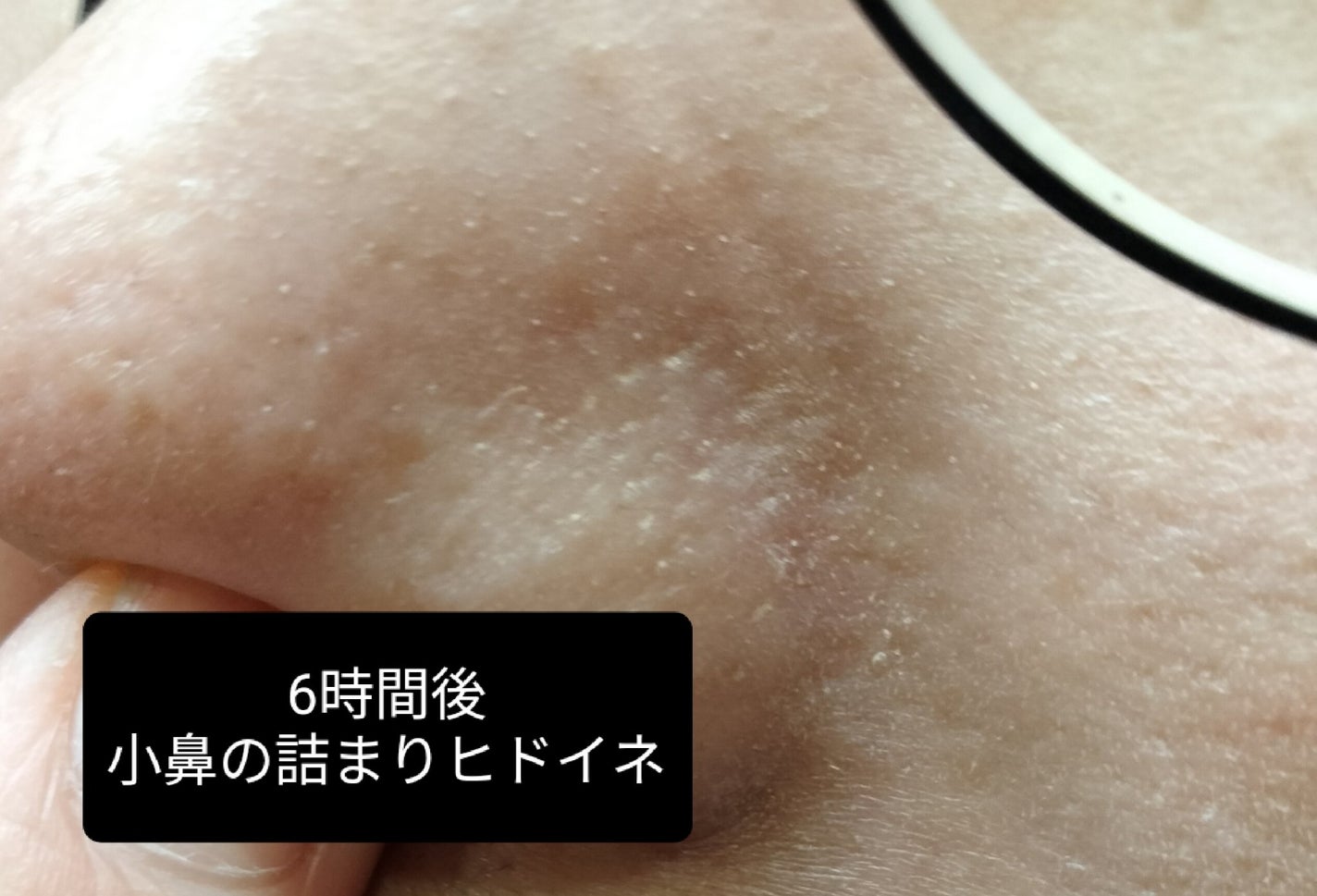 SPステイ ルミマット リキッド ファンデーション/MAYBELLINE NEW YORK/リキッドファンデーションを使ったクチコミ(3枚目)