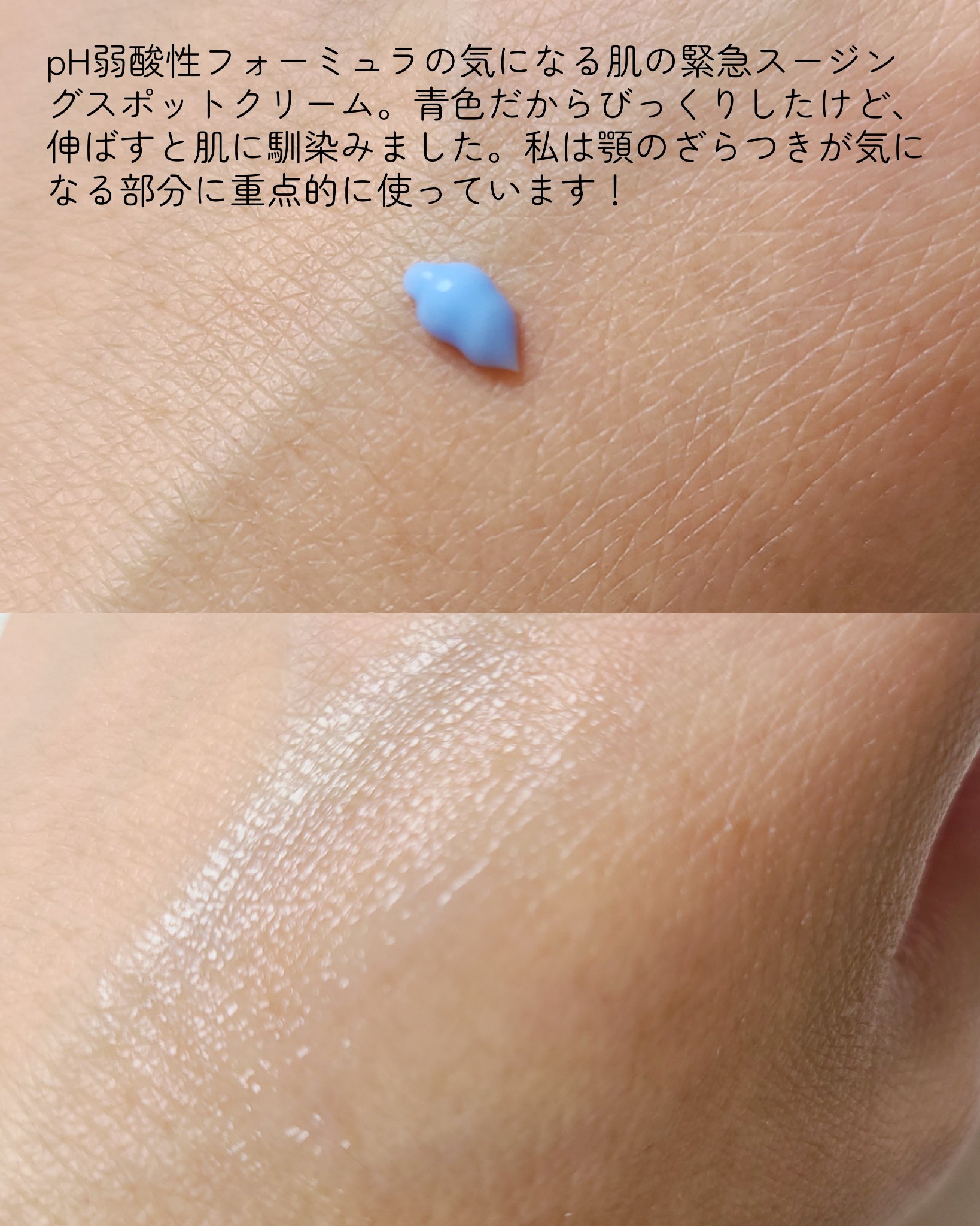PHセンシティブスポットクリーム/SAM'U/フェイスクリームを使ったクチコミ（2枚目）