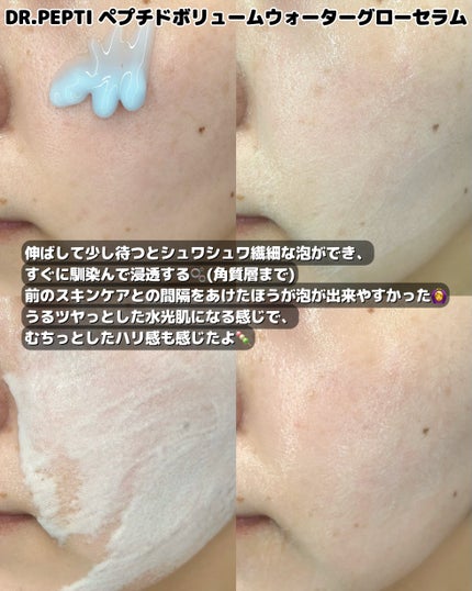 センテラティーツリーモデリングマスク/DR.PEPTI/シートマスク・パックを使ったクチコミ(3枚目)