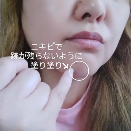 PHセンシティブスポットクリーム/SAM'U/フェイスクリームを使ったクチコミ(6枚目)