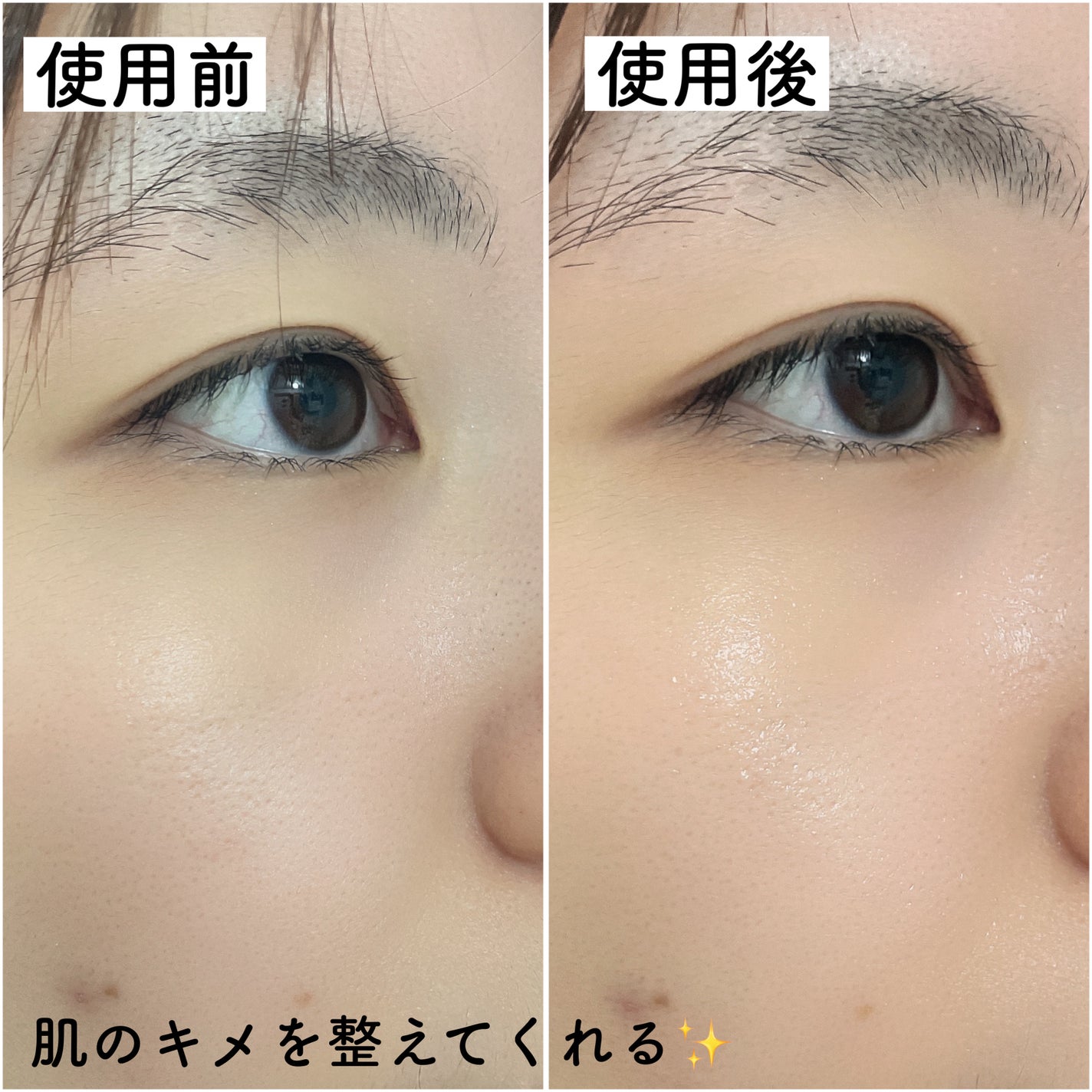 PHセンシティブトナーパッド/SAM'U/トナーパッドを使ったクチコミ(7枚目)