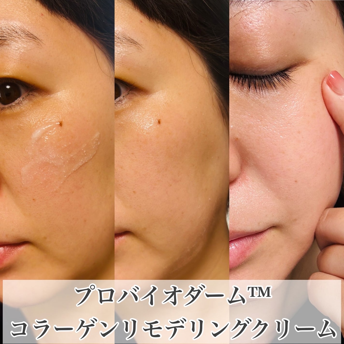 ãã€ãªããŒã«ã ãããã€ãªããŒã 3Dãªããã£ã³ã°ã¯ãªãŒã /BIOHEAL BOH/ãã§ã€ã¹ã¯ãªãŒã ã䜿ã£ãã¯ãã³ãïŒ6æç®ïŒ