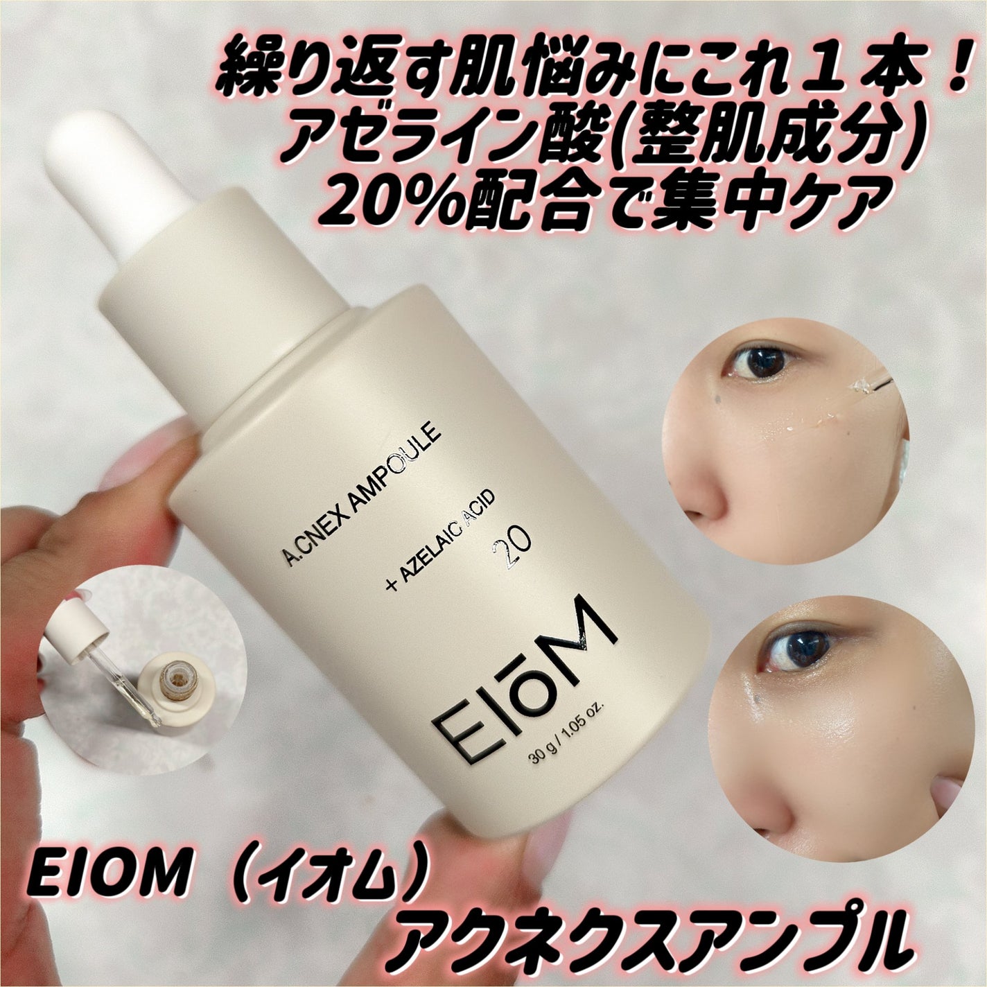 アクネクスアンプル/EIOM/美容液を使ったクチコミ(1枚目)