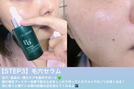 ポアタイトニングブーストセラム/CELORABY/美容液を使ったクチコミ(4枚目)