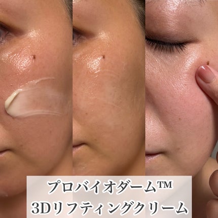 ãã€ãªããŒã«ã ãããã€ãªããŒã 3Dãªããã£ã³ã°ã¯ãªãŒã /BIOHEAL BOH/ãã§ã€ã¹ã¯ãªãŒã ã䜿ã£ãã¯ãã³ãïŒ5æç®ïŒ