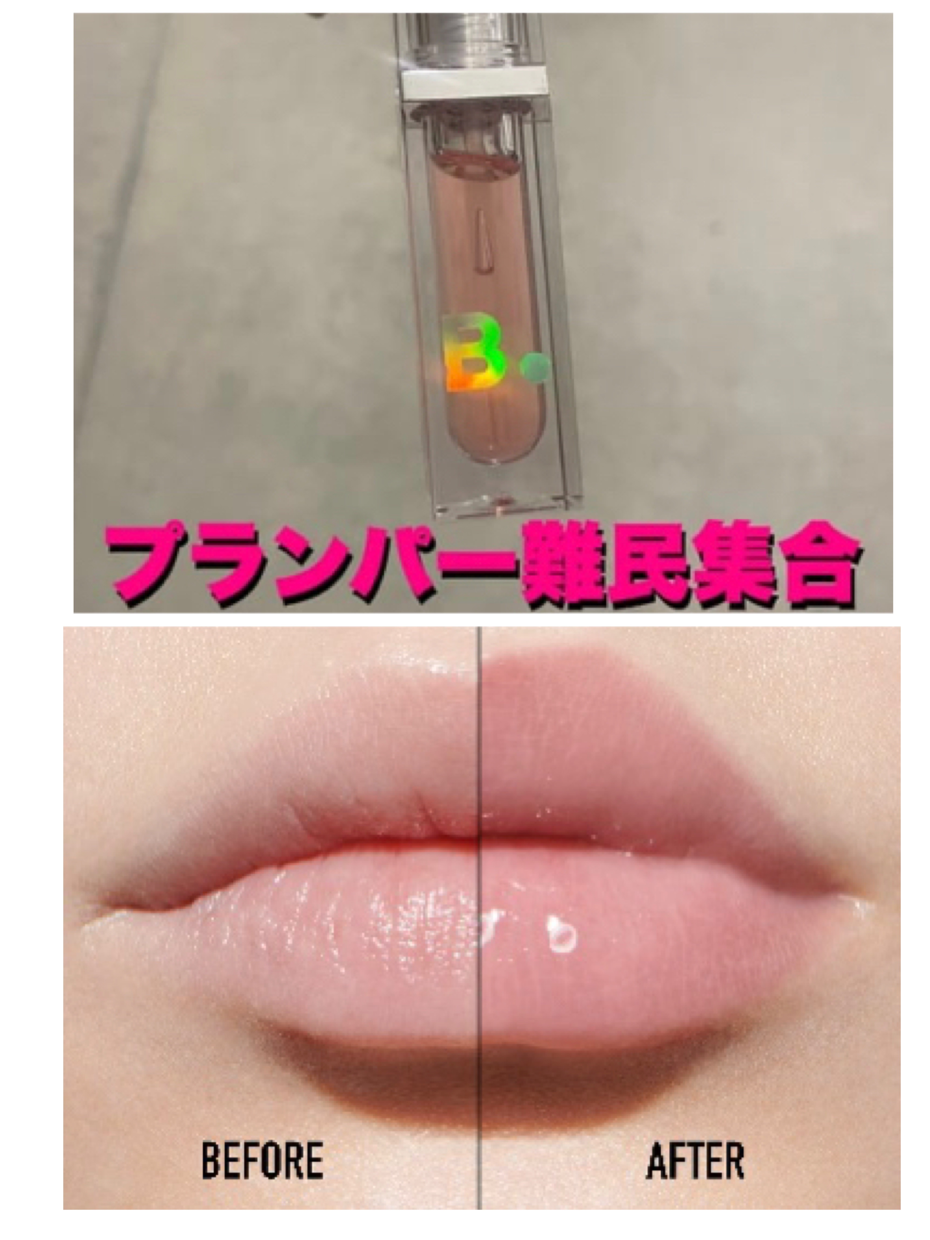 ボリュームリッププランパー/BANILA CO/リッププランパーを使ったクチコミ（1枚目）