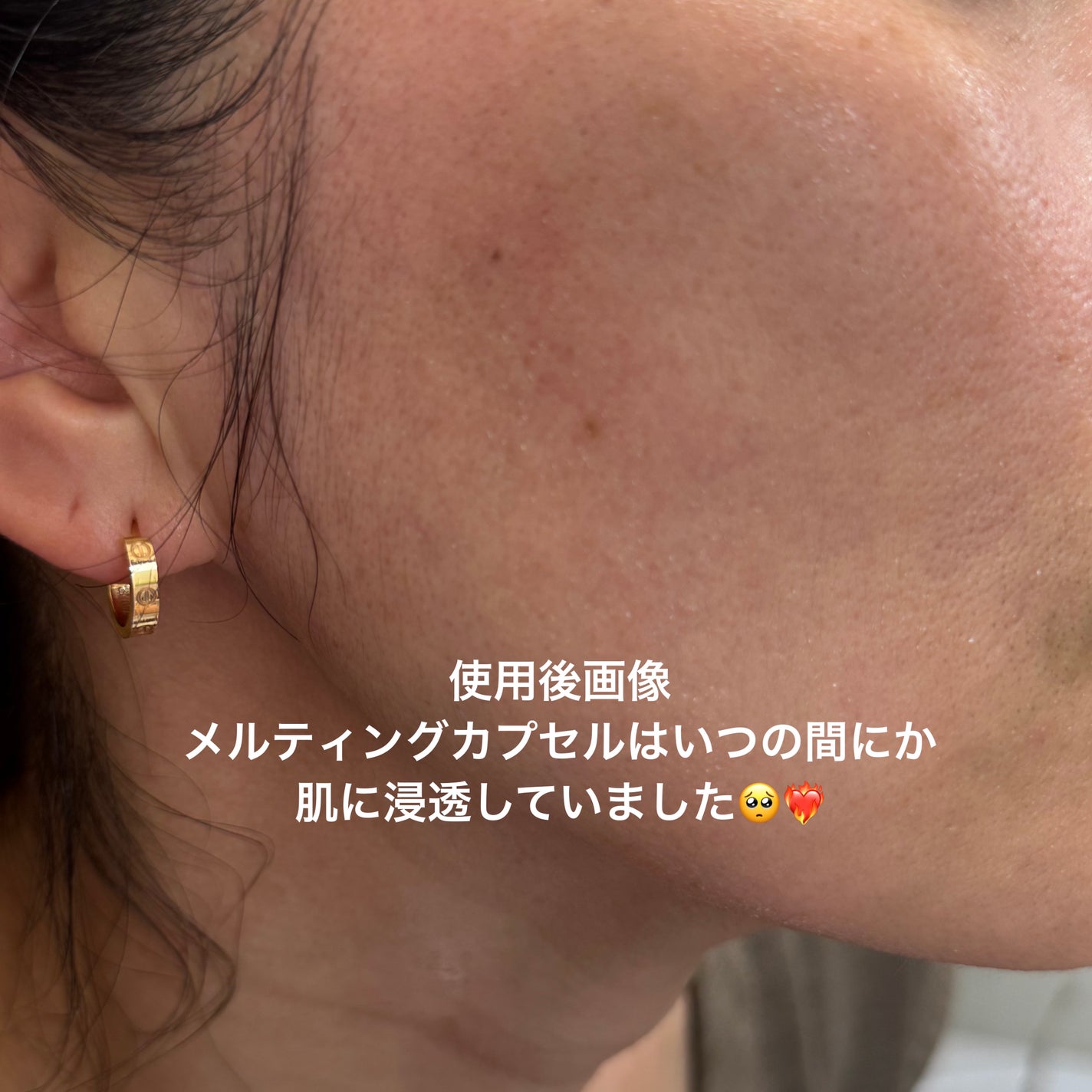 ビタミンアンプル2ml(5本入り)/Spela/美容液を使ったクチコミ(7枚目)