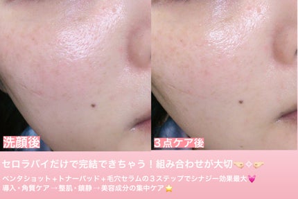 ポアタイトニングブーストセラム/CELORABY/美容液を使ったクチコミ(5枚目)