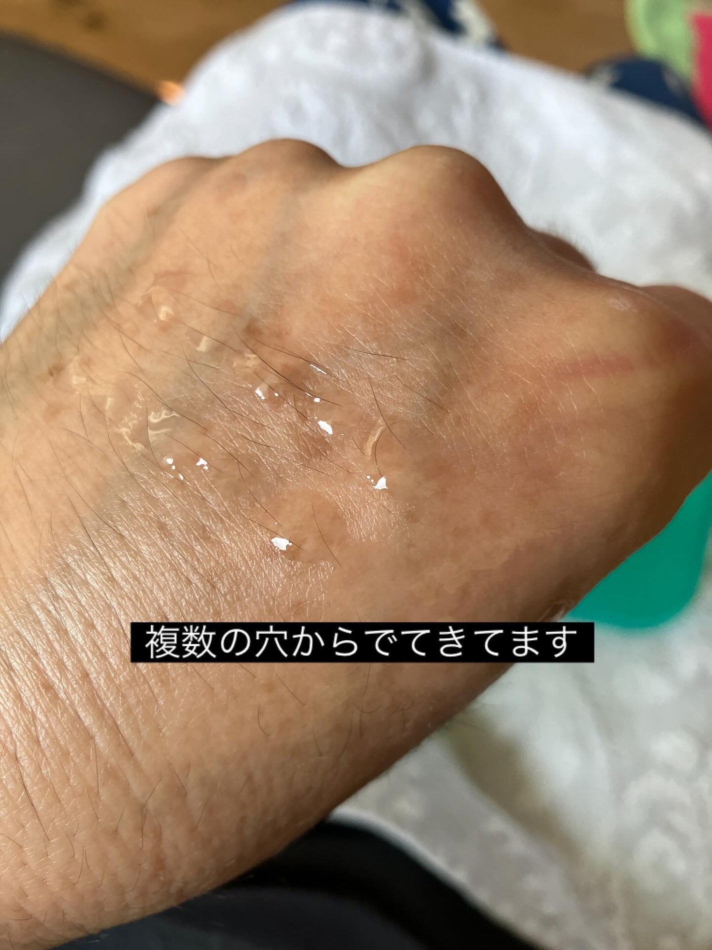 スカルプターンヘアアンプル/リリーイブ/頭皮ローションを使ったクチコミ(3枚目)