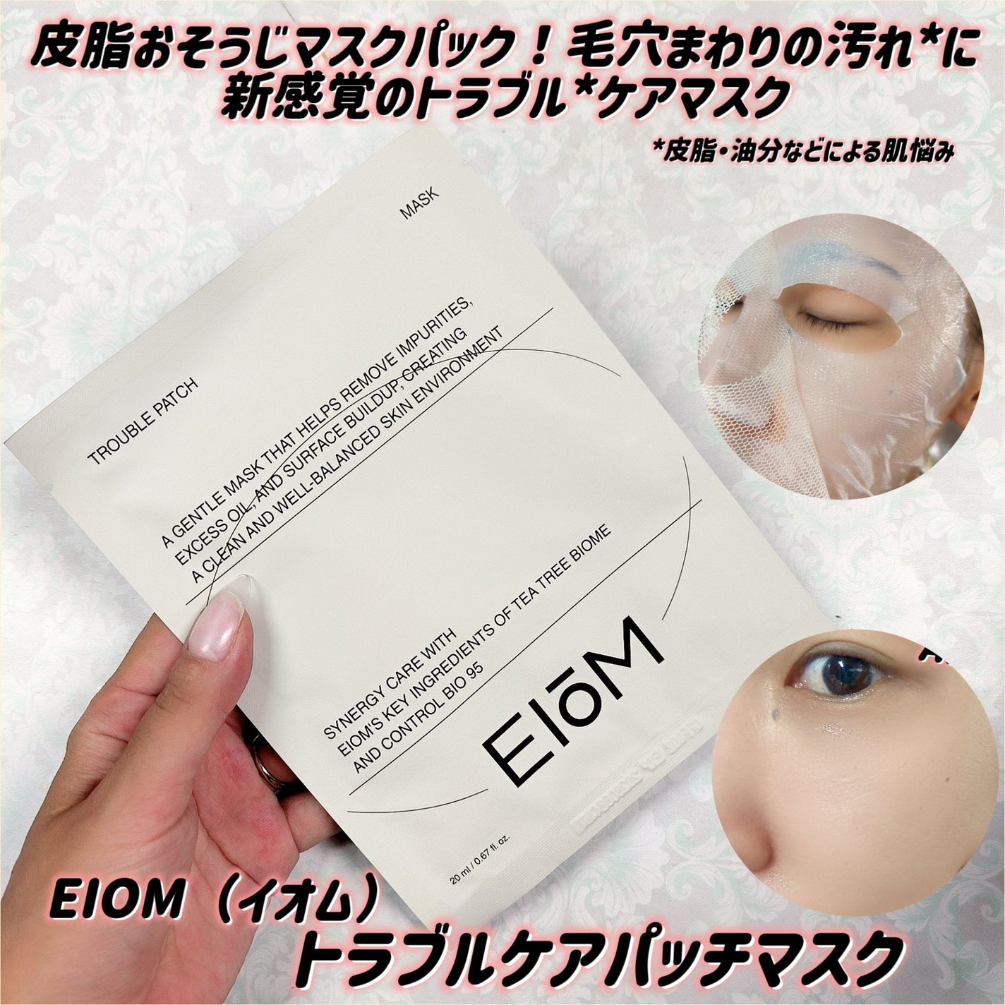 トラブルパッチマスク/EIOM/その他スキンケアを使ったクチコミ(1枚目)