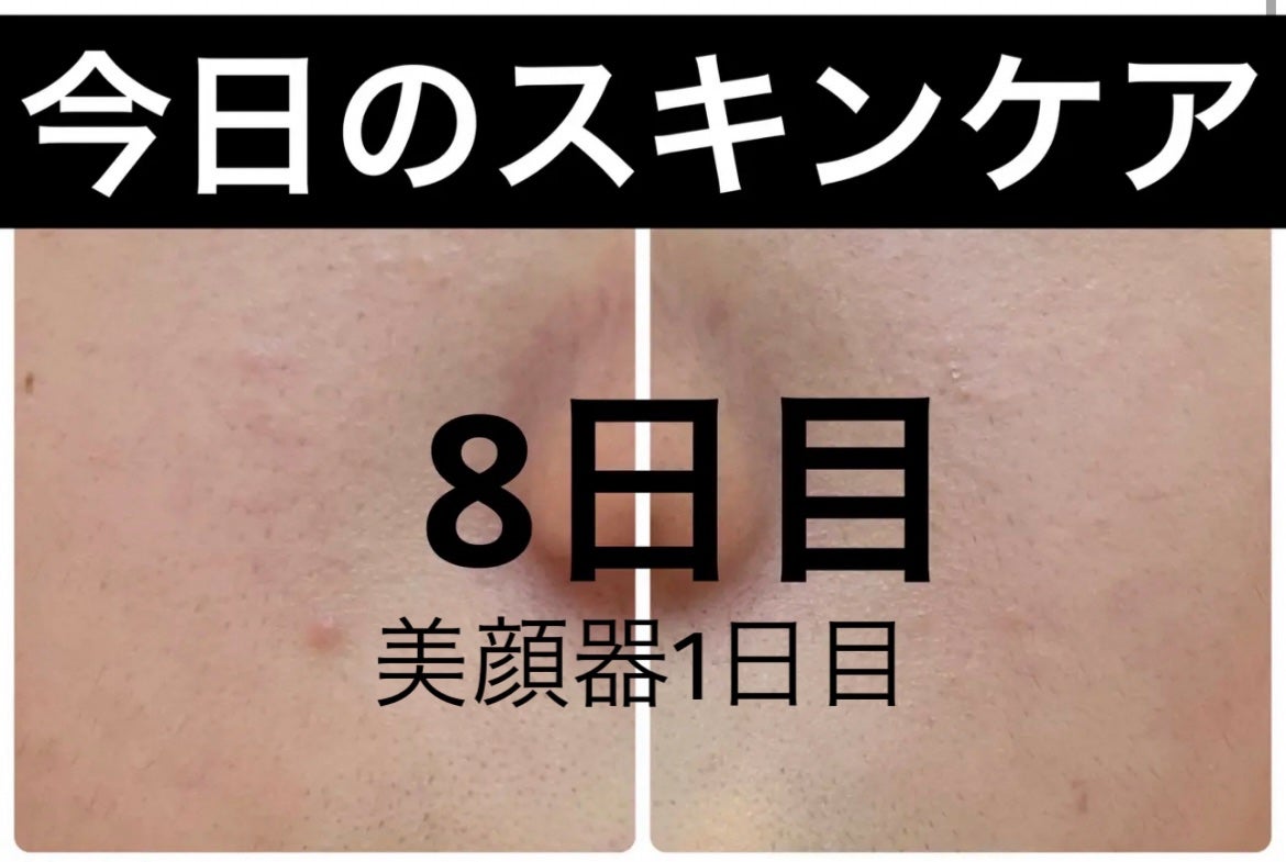 クリアアップローション 1/IPSA/化粧水を使ったクチコミ(1枚目)