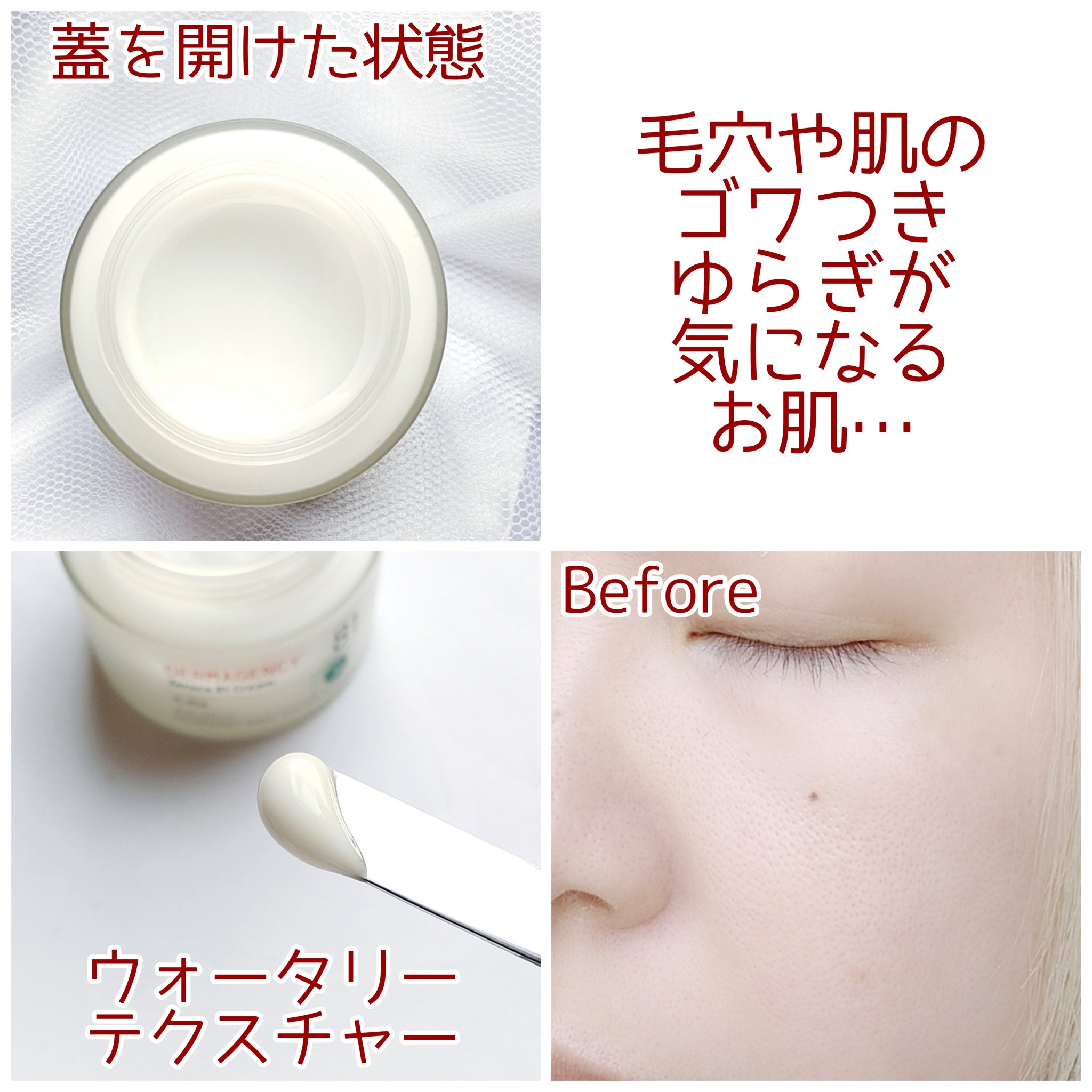 ダーマジェンシー ゼロカ81 クリーム/DERMAGENCY/フェイスクリームを使ったクチコミ（3枚目）