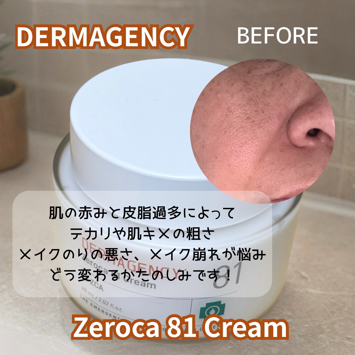 ダーマジェンシー ゼロカ81 クリーム/DERMAGENCY/フェイスクリームを使ったクチコミ(5枚目)