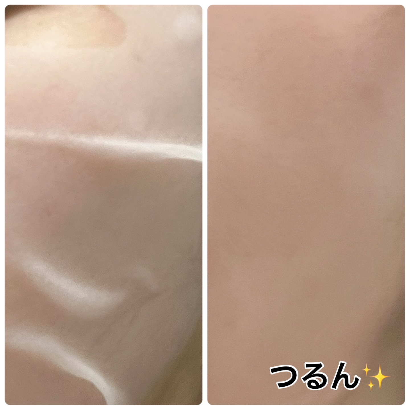 hadatore ピールマスク 13[シートマスク]/hadatore/シートマスク・パックを使ったクチコミ（2枚目）