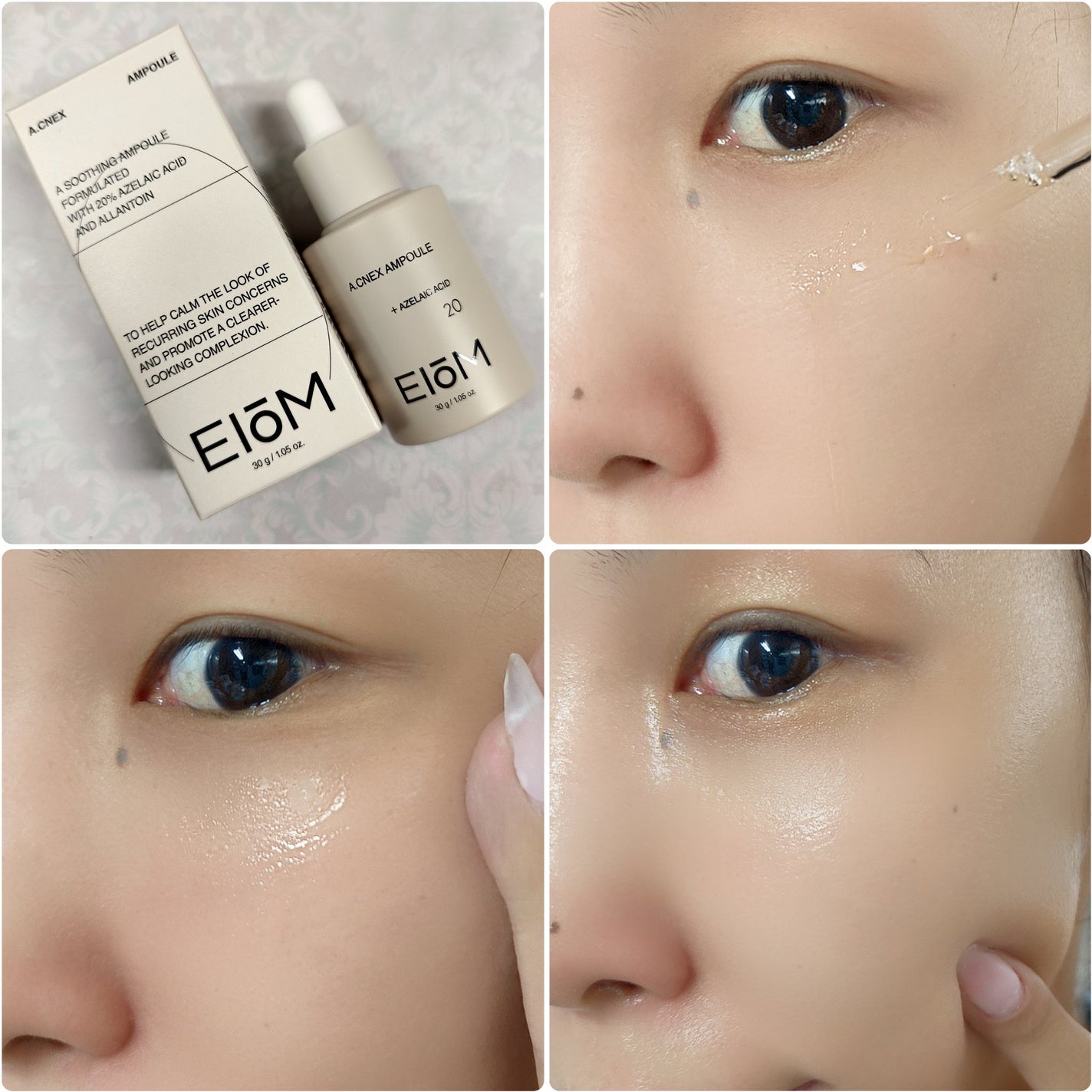 アクネクスアンプル/EIOM/美容液を使ったクチコミ(3枚目)