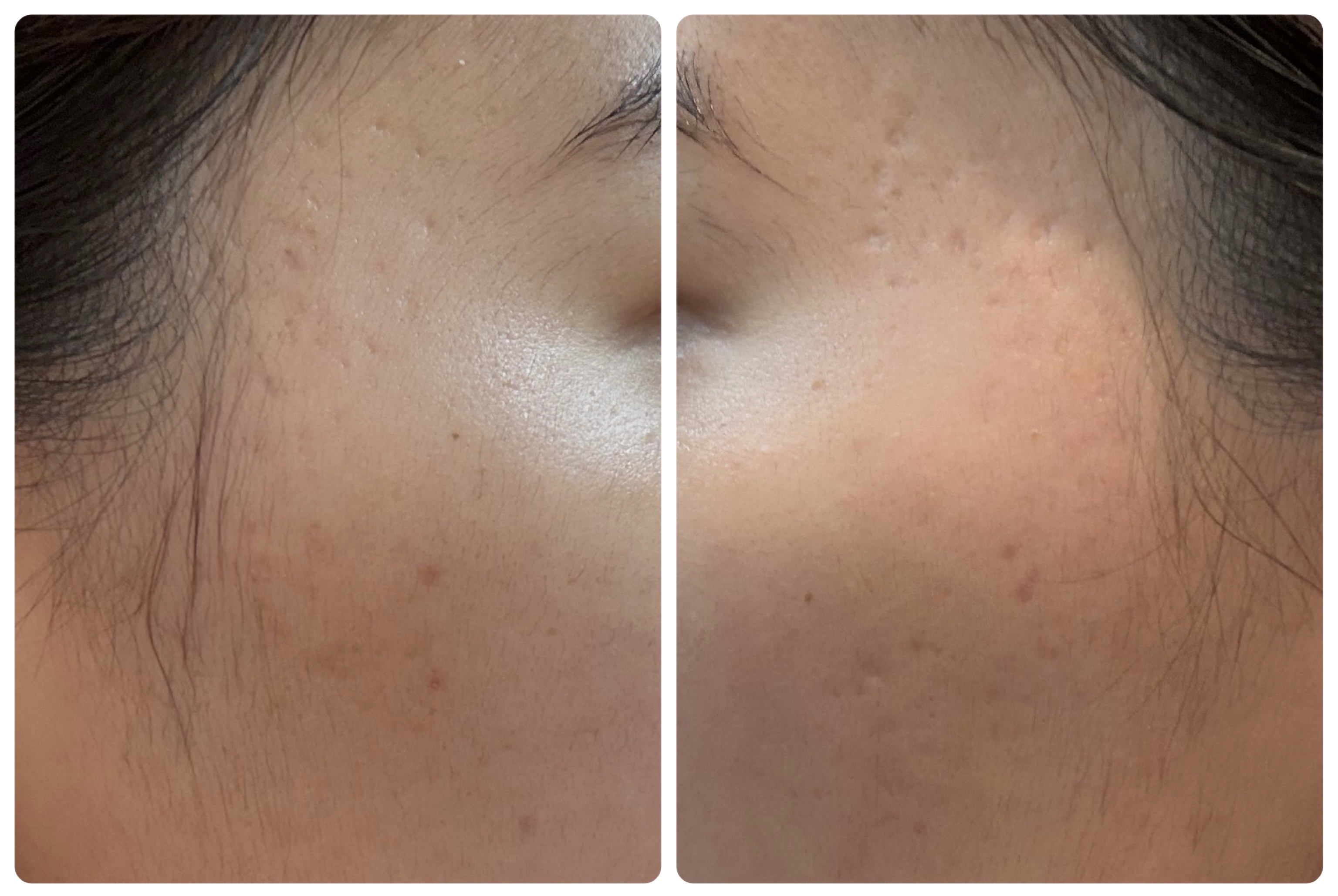 Hadaral 十味敗毒湯錠(医薬品)/大峰堂/その他を使ったクチコミ（2枚目）