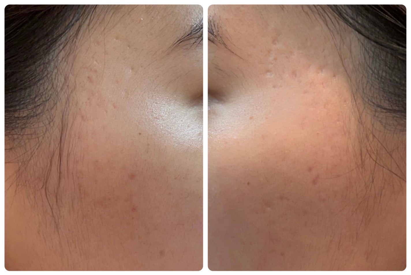 クリアアップローション 1/IPSA/化粧水を使ったクチコミ(2枚目)