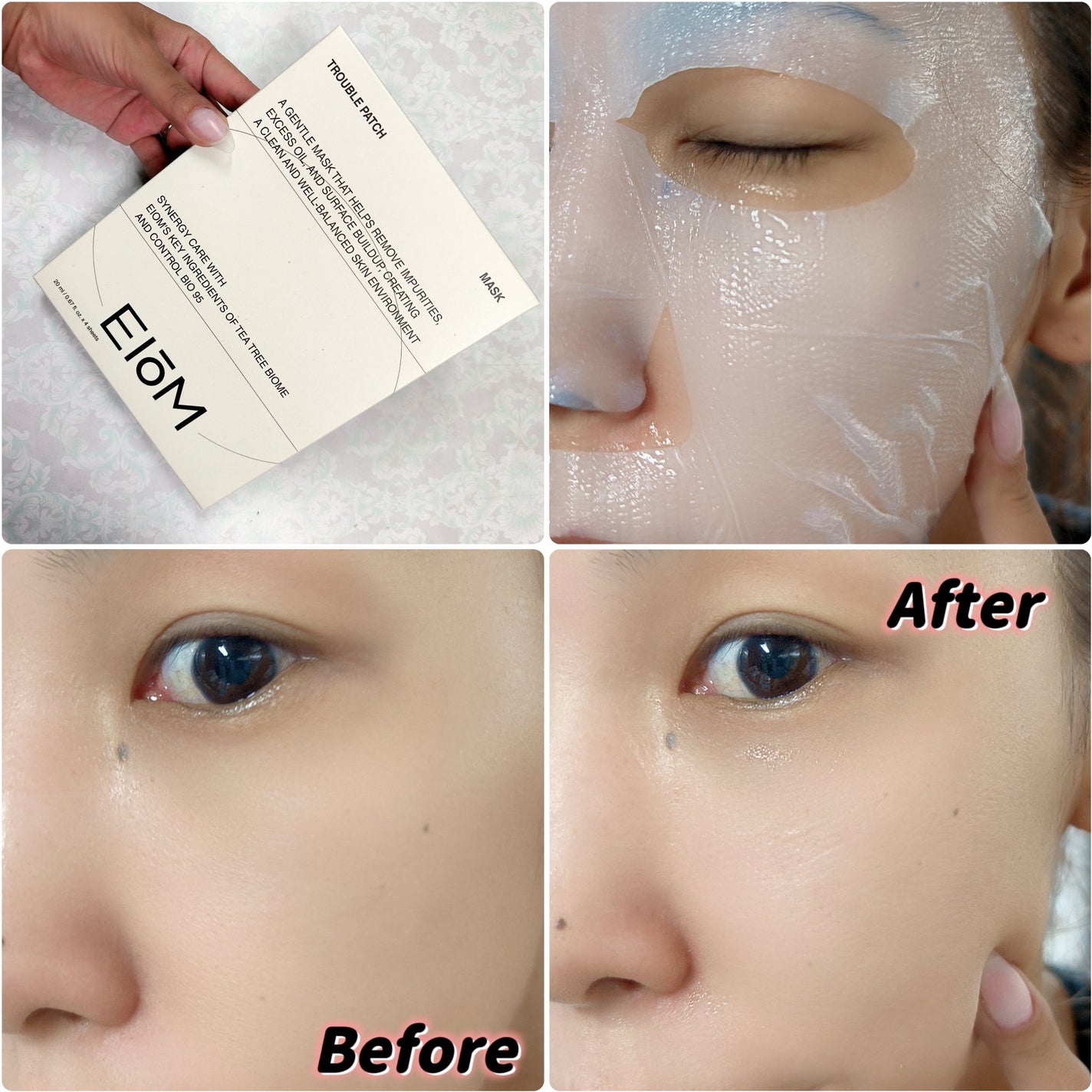 トラブルパッチマスク/EIOM/その他スキンケアを使ったクチコミ(4枚目)