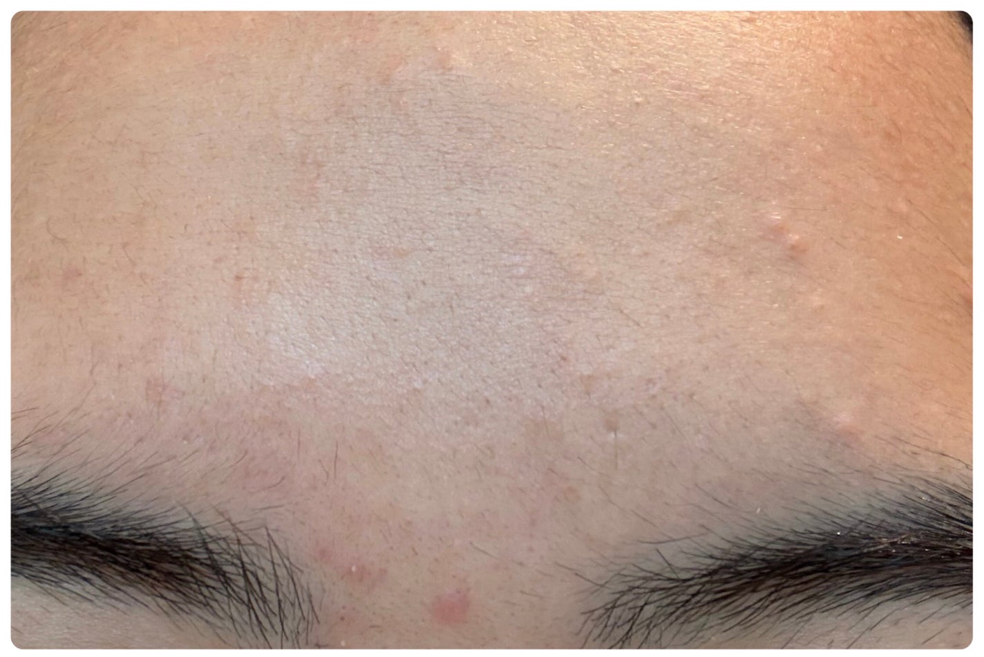 ディープブーストセラム/ブルーミオ/美容液を使ったクチコミ(4枚目)