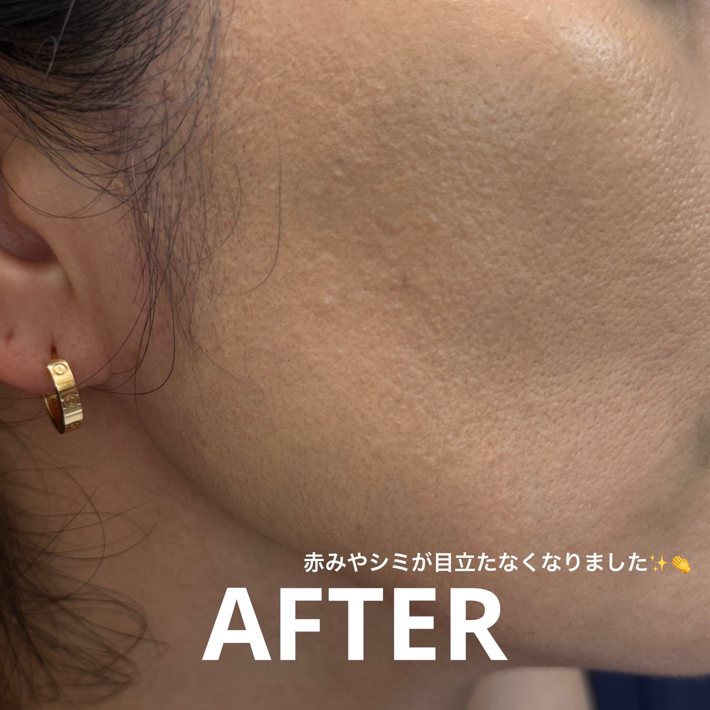 スキンエンハンサー コンパクト クッション (マット)/BROOKESIA/クッションファンデーションを使ったクチコミ(5枚目)