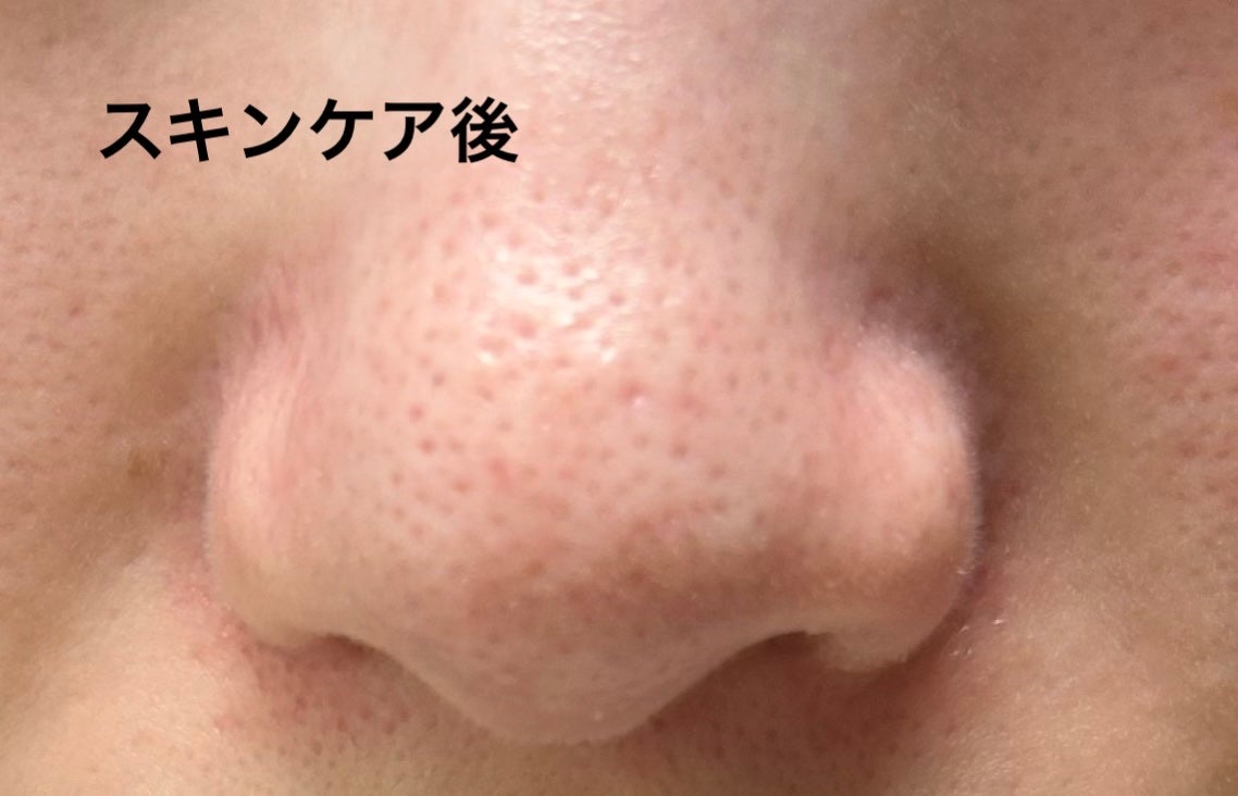 ポアクリア スクラブ ウォッシュ/ONE BY KOSE/洗顔フォームを使ったクチコミ(5枚目)