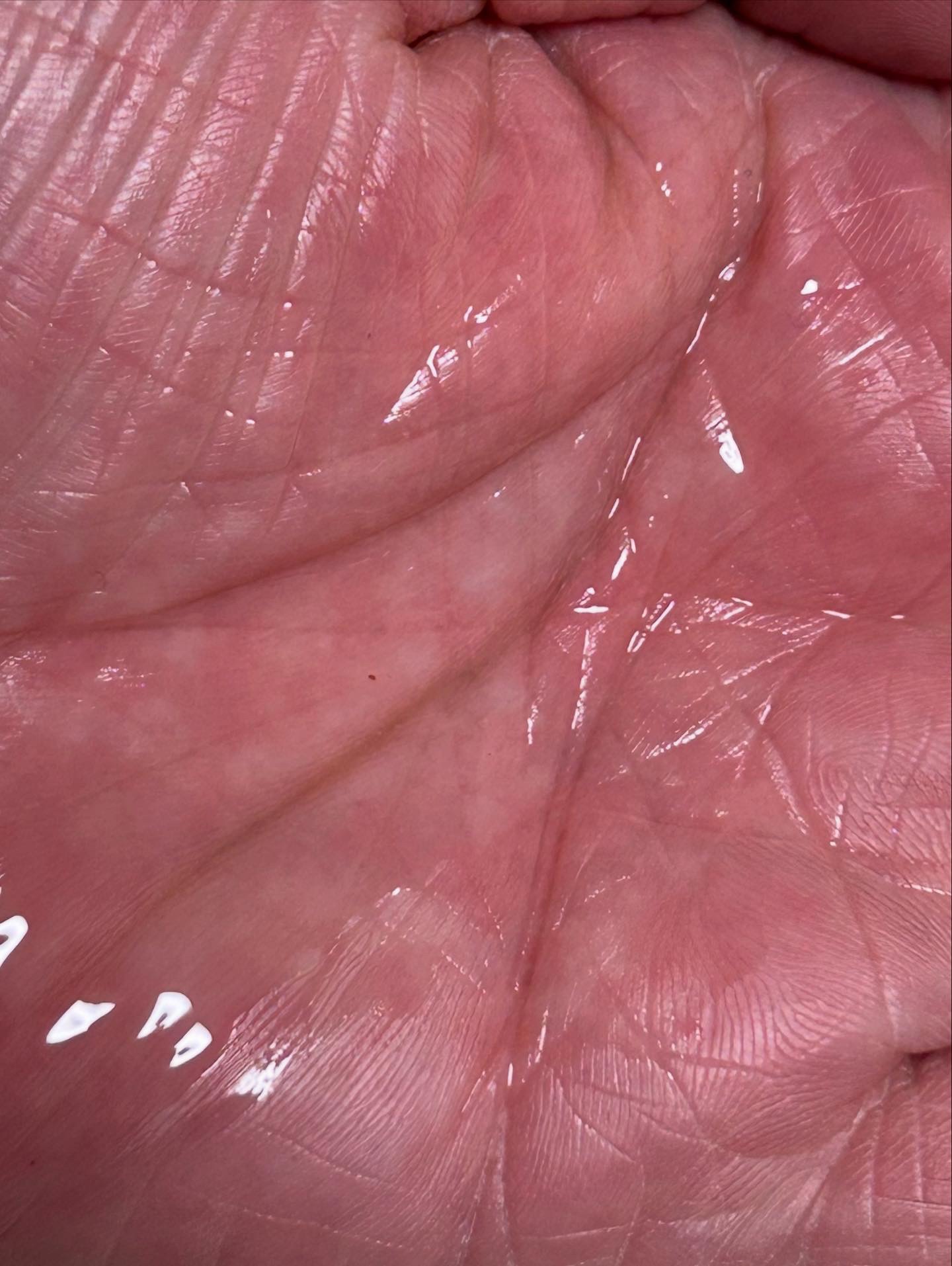 スカルプターンヘアアンプル/リリーイブ/頭皮ローションを使ったクチコミ（2枚目）