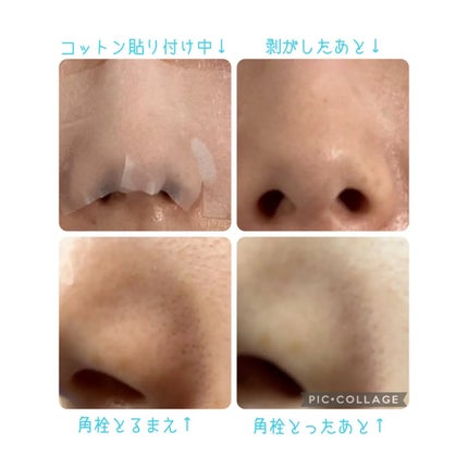 ディープクリーンマスター/ilso/その他スキンケアグッズを使ったクチコミ(3枚目)