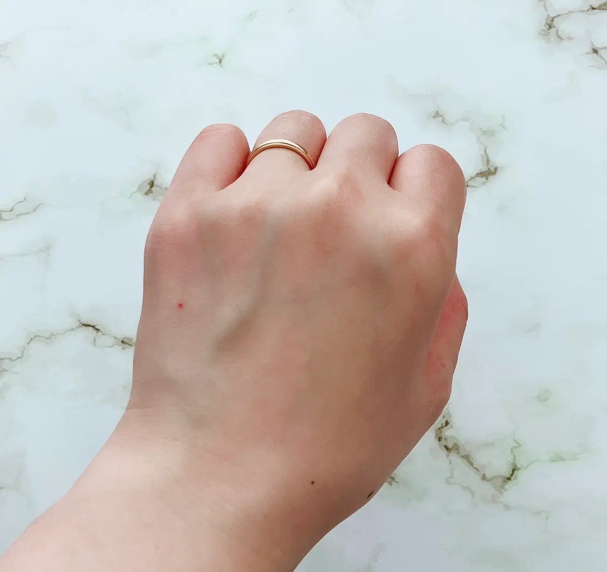 ダーマジェンシー ゼロカ81 セラム/DERMAGENCY/美容液を使ったクチコミ(4枚目)