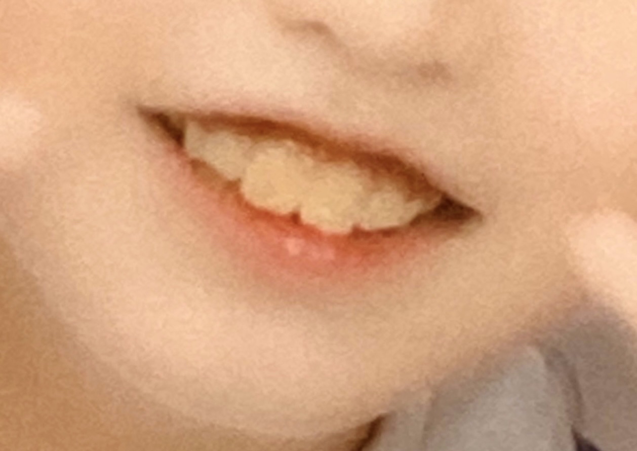 歯みがきペーストホワイト/ルシェロ/歯磨き粉を使ったクチコミ（1枚目）