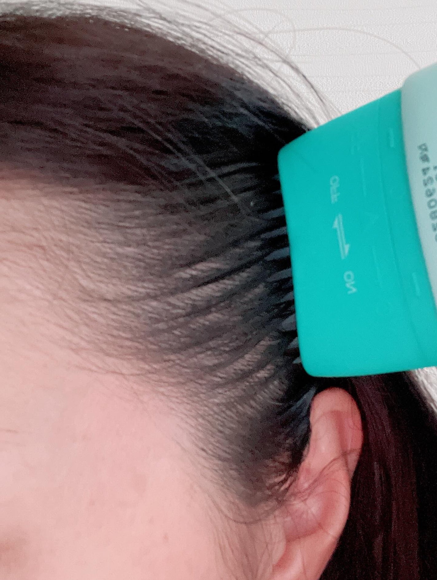 パイン on LIPS 「スカルプターンヘアアンプル使ってみました♪真夏の頭皮、べたつき..」(4枚目)