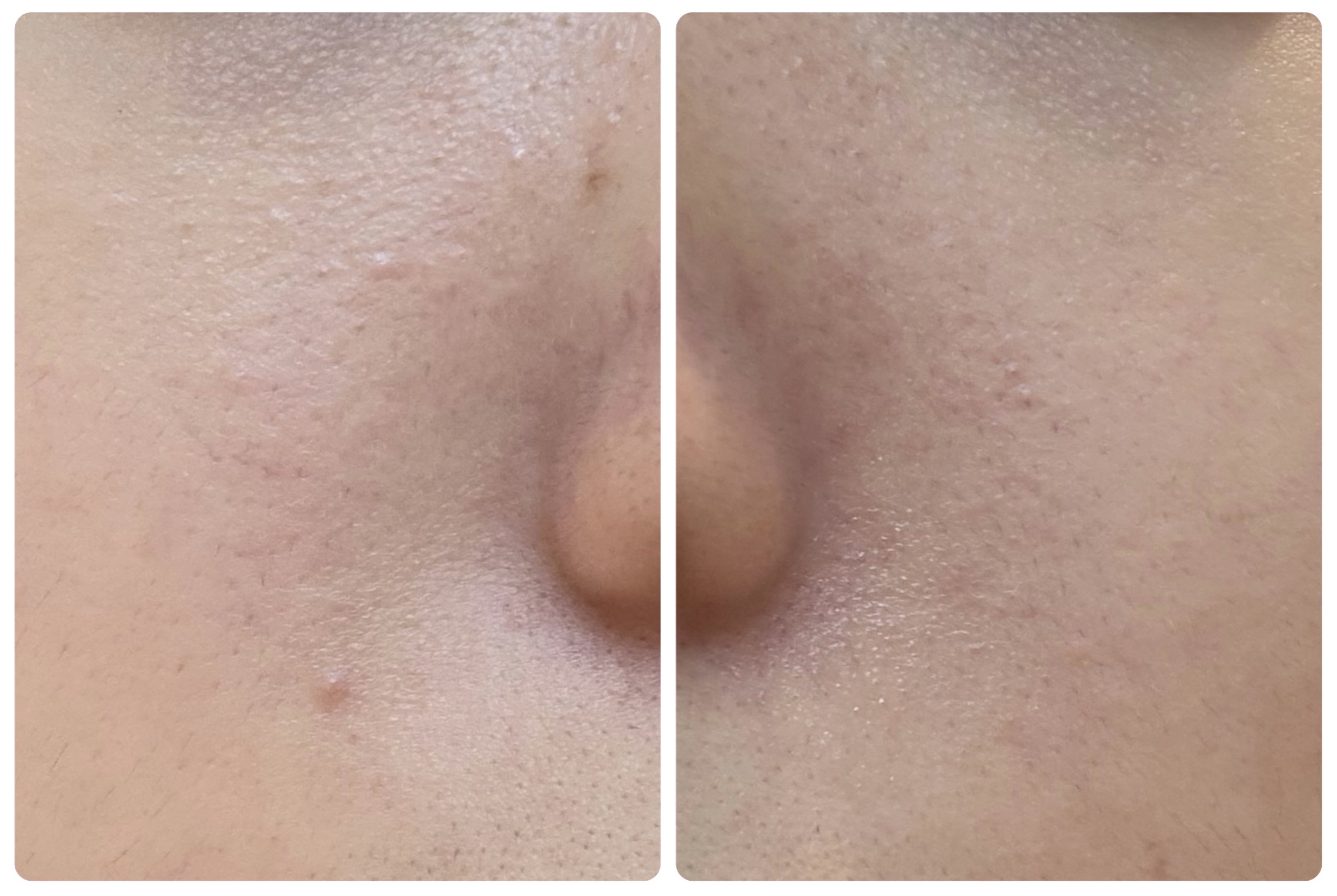 AGE-R ブースタープロ/MEDICUBE/美顔器・マッサージを使ったクチコミ（3枚目）