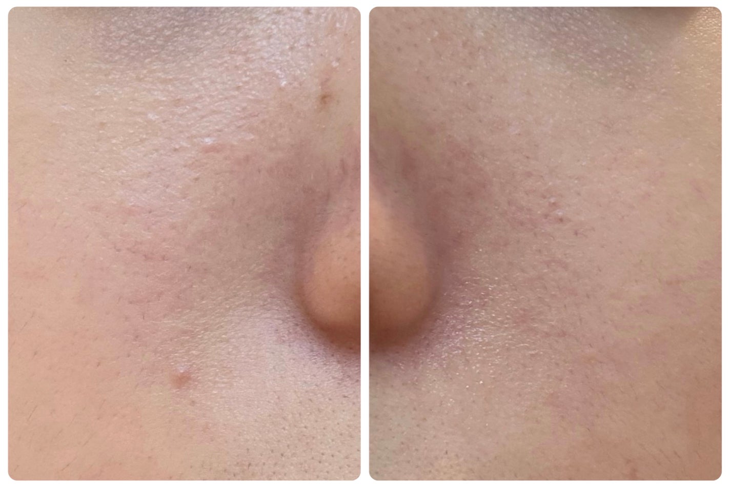 ディープブーストセラム/ブルーミオ/美容液を使ったクチコミ(3枚目)