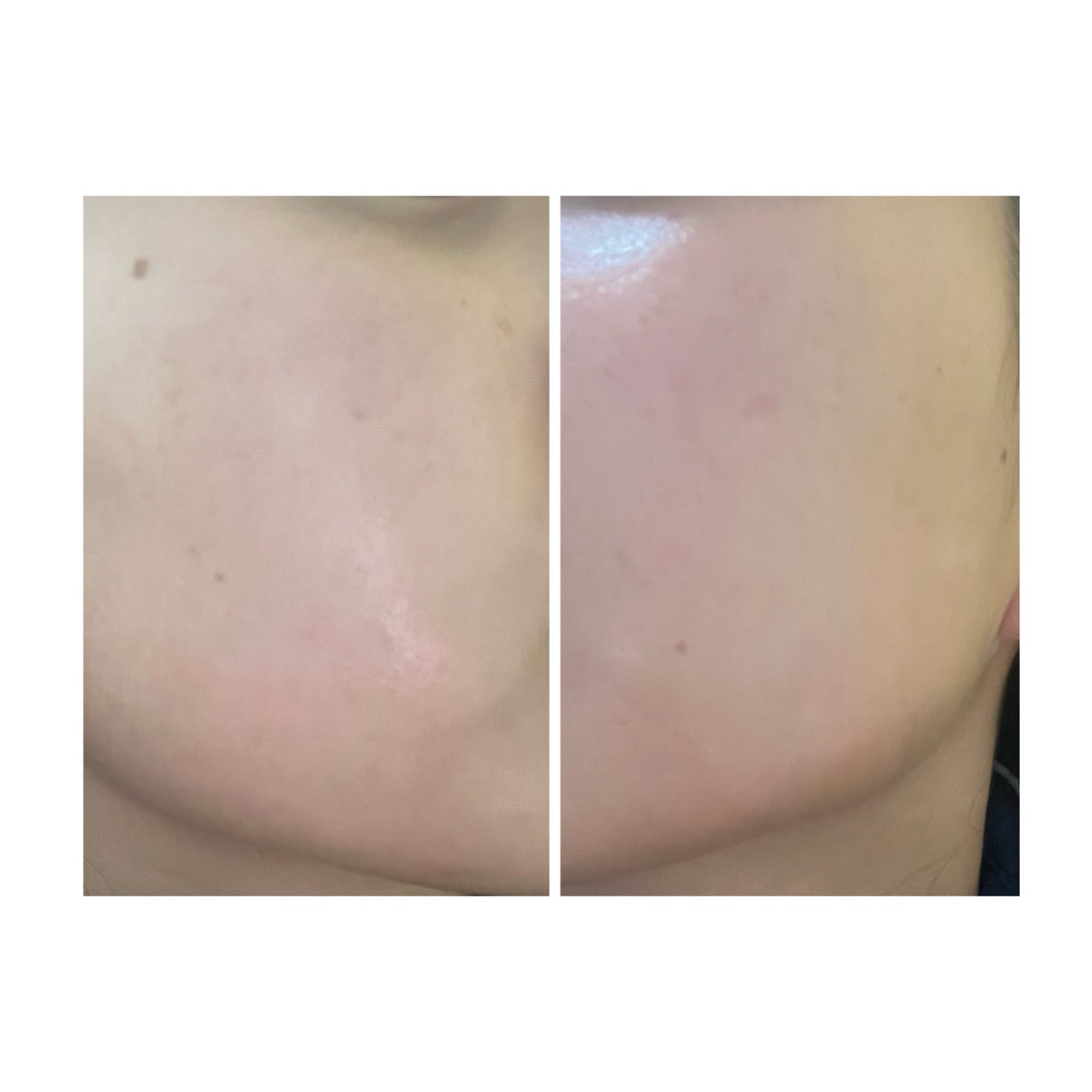 ぽむ on LIPS 「1枚目 2025.8.19エピデュオ 706日目2枚目 202..」(3枚目)