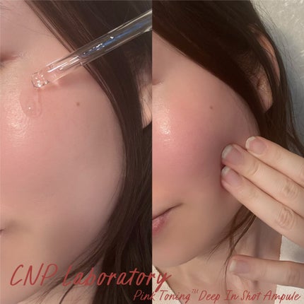 ピンクトーニング™︎ディープインショットアンプル/CNP Laboratory/美容液を使ったクチコミ(5枚目)