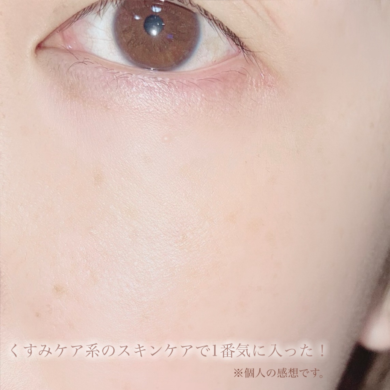 ポア ブライトニング シミケアセラム/celimax/美容液を使ったクチコミ（3枚目）