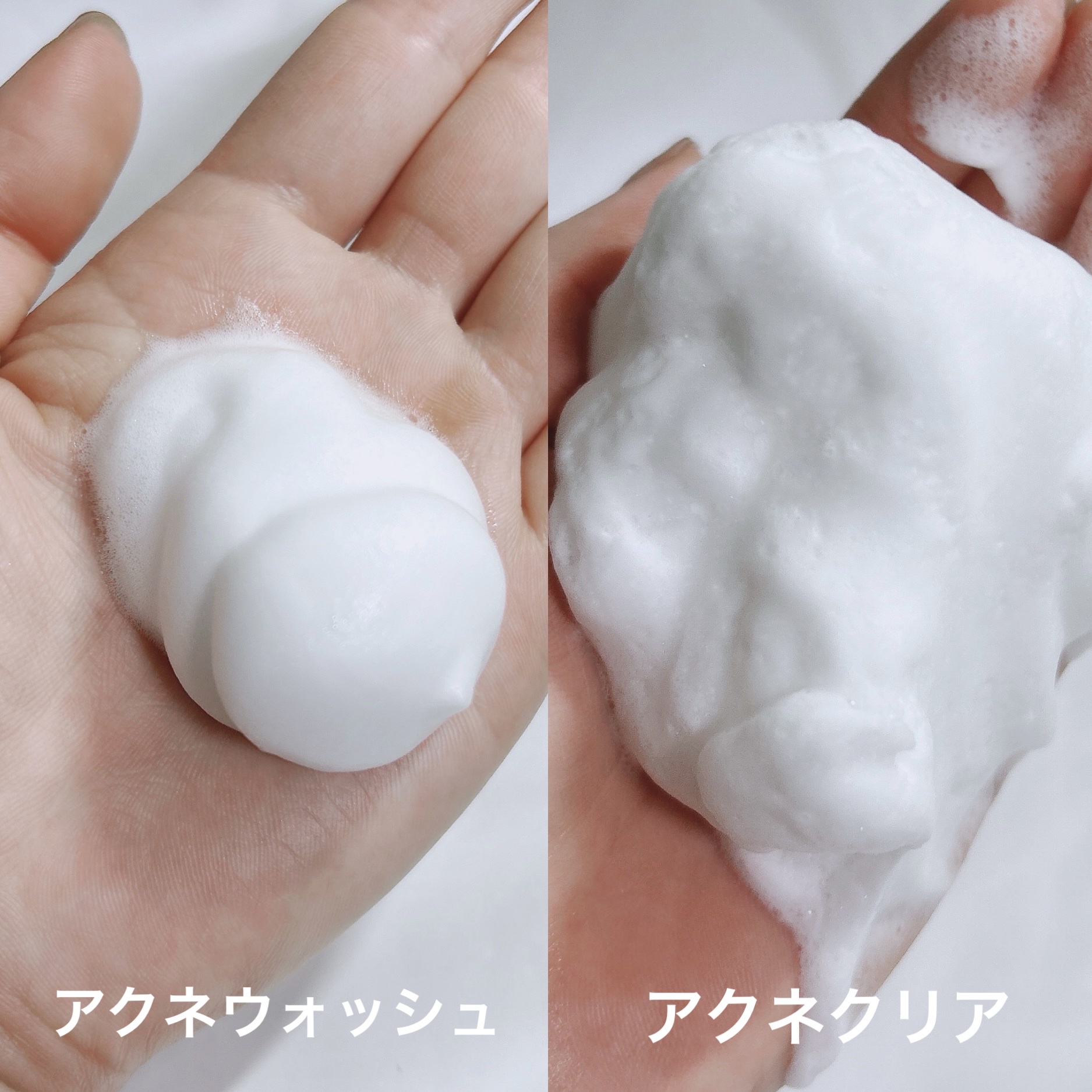 ロゼット洗顔パスタ アクネクリア/ロゼット/洗顔フォームを使ったクチコミ（2枚目）