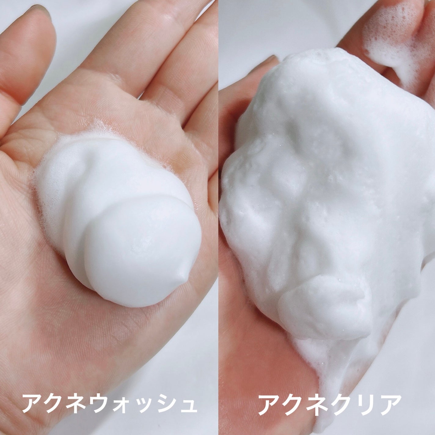 ロゼット洗顔パスタ アクネクリア/ロゼット/洗顔フォームを使ったクチコミ(2枚目)