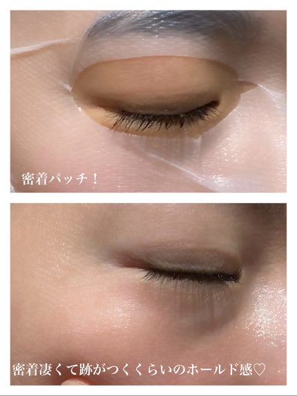 トラブルパッチマスク/EIOM/その他スキンケアを使ったクチコミ(4枚目)